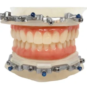 Provisional Implant PMMA (Plus Parts)