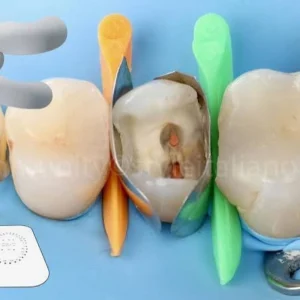 Hot Bonding Treatment on Any Zirconia Structure (P/Unit)