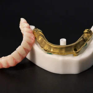 Full Arch Zirconia (Ti-Bar)